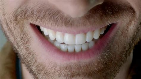 American Association of Orthodontists TV Spot, 'Your Teeth'