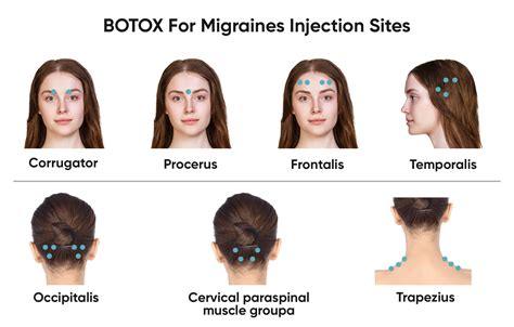 BOTOX (Migraine) Cosmetic logo
