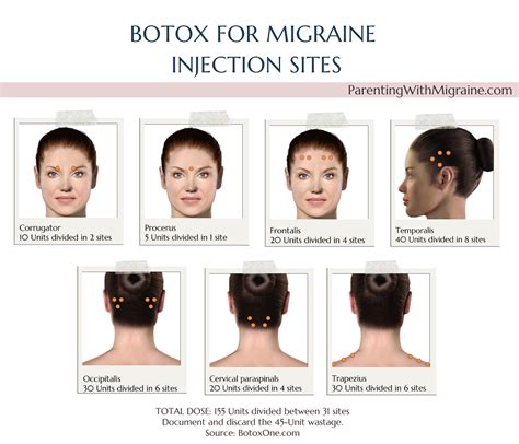 BOTOX (Migraine) TV commercial - Questions