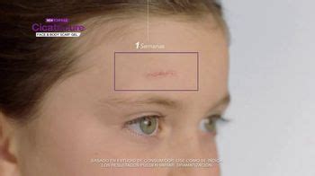 Cicatricure Face & Body Scar Gel TV Spot, 'Historias reales: Oli'