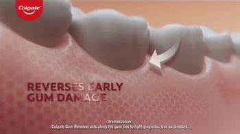 Colgate Gum Renewal TV commercial - Reverse Early Damage