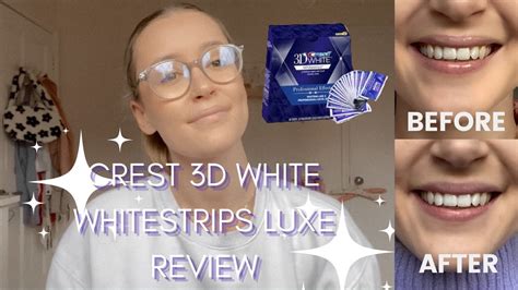 Crest 3D White Whitestrips Luxe TV Spot, 'That's Not Fair'