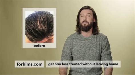 Hims TV Spot, 'Help for Hair Loss' created for Hims