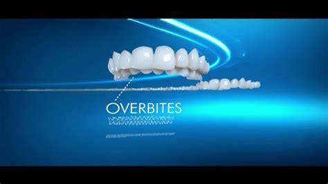 Invisalign TV commercial - Broad Range of Dental Issues