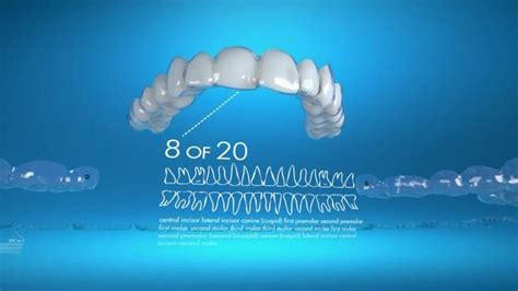 Invisalign TV Spot, 'Gradually Straighten Your Teeth' created for Invisalign