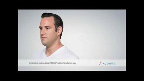 KYBELLA TV Spot, 'Invest in Your Profile'
