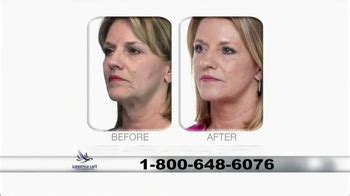 Lifestyle Lift TV Spot, 'A Life-Changing Procedure' created for Lifestyle Lift