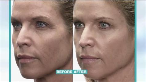MD Complete Anti-Aging Kit TV Spot, 'The Results Are In' featuring Elizabeth Gast
