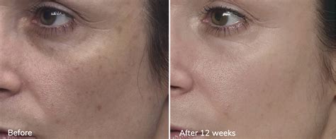 MD Complete Skincare Anti-Aging TV commercial - Results