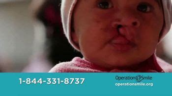 Operation Smile TV commercial - Children Born With Cleft Conditions