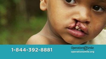 Operation Smile TV commercial - Cleft Conditions: Surgery