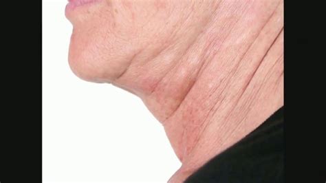Perricone MD TV Spot, 'Visibily Firmer Neck: 20 Dollars Off' created for Perricone MD
