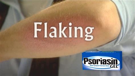 Psoriasin TV Commercial for Healthier Skin featuring George Tafelski
