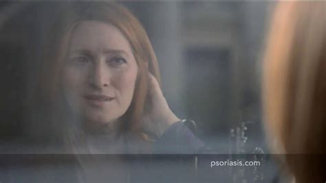 Psoriasis Speaks TV Spot, 'Open and Honest'