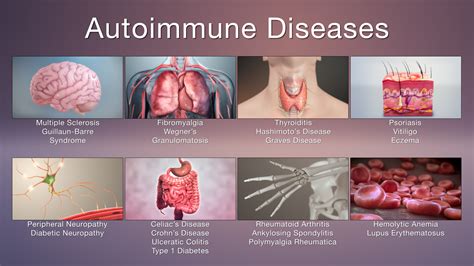 Immune Disease photo