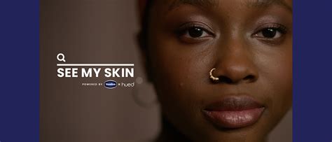 Vaseline TV Spot, 'See My Skin'